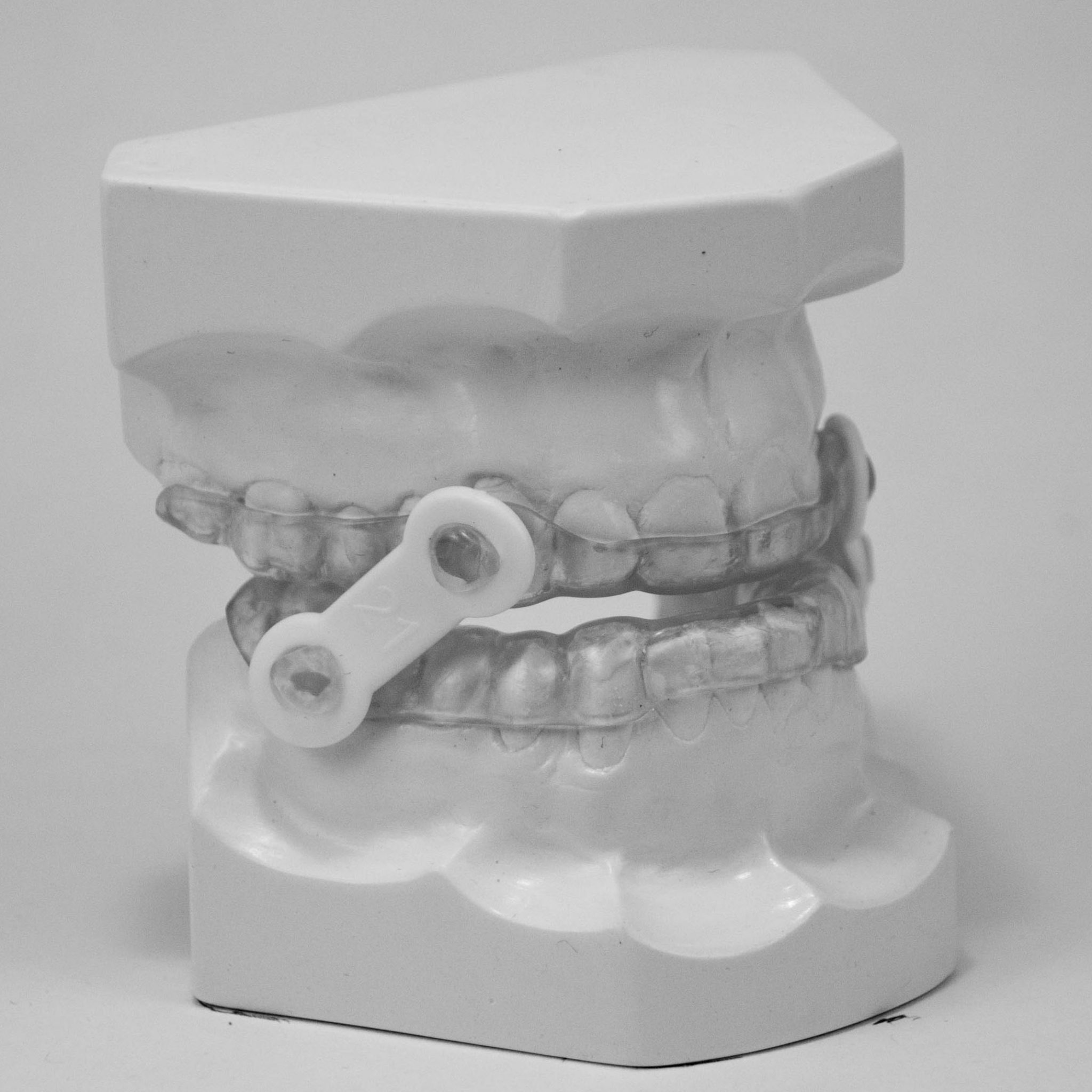 Sleep Appliances Dental Lab in Ottawa Watersedge Dental Laboratory Inc.