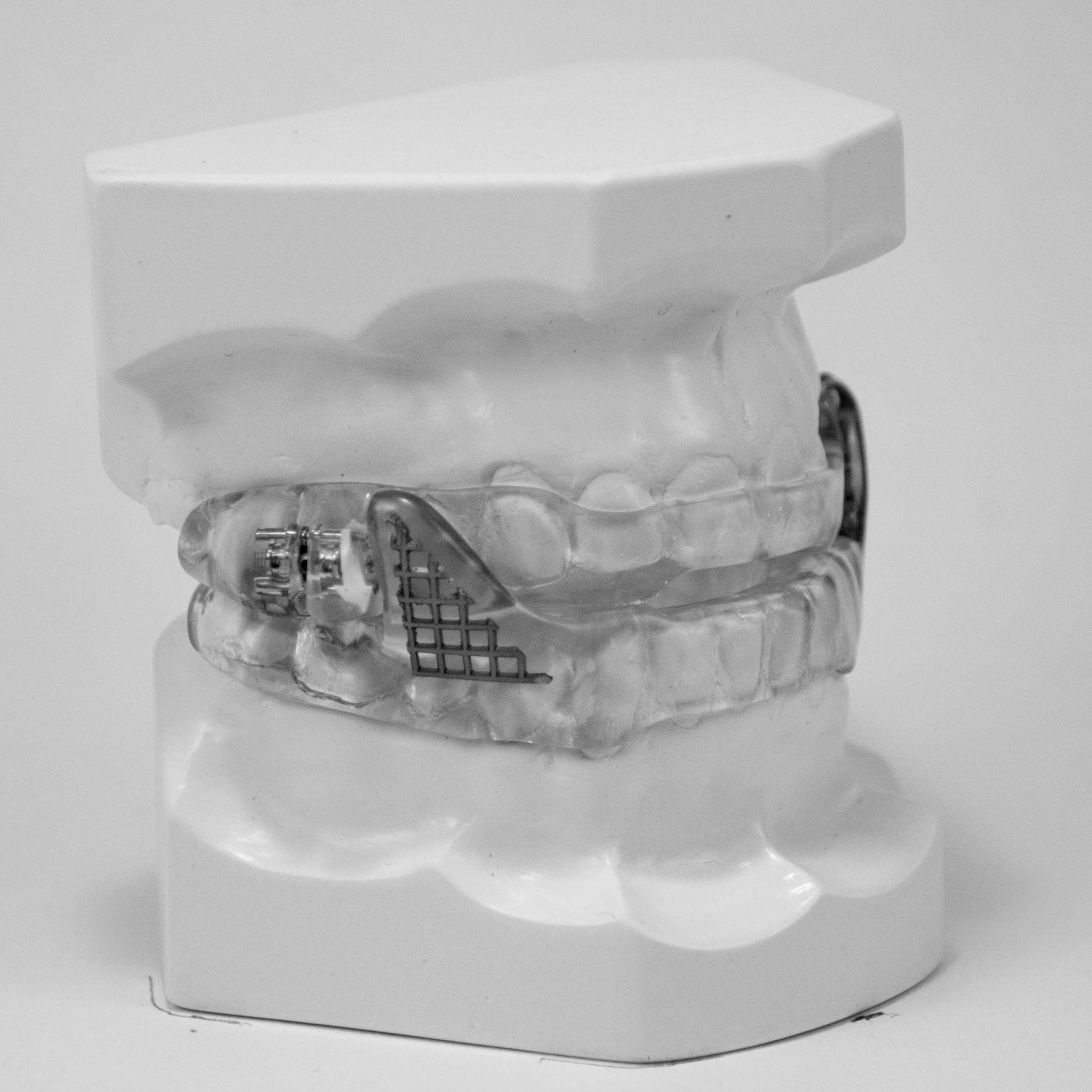 Sleep Appliances Dental Lab in Ottawa Watersedge Dental Laboratory Inc.