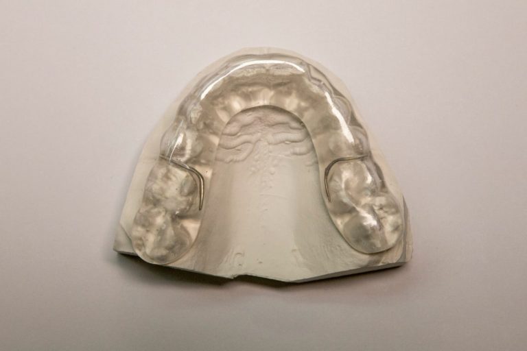 Night Guards and Sports Guards in Ottawa Watersedge Dental Laboratory