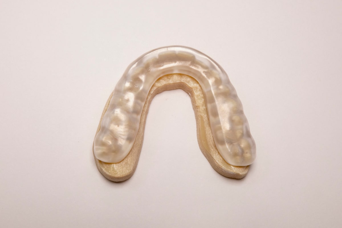 Night Guards and Sports Guards in Ottawa Watersedge Dental Laboratory