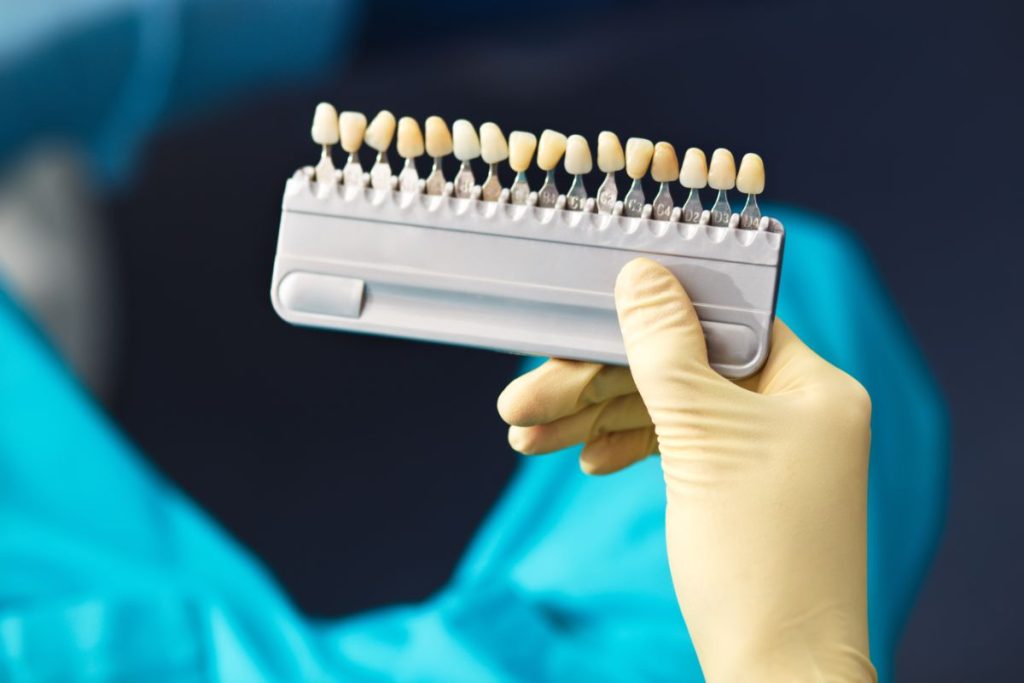 Dental Shade Matching