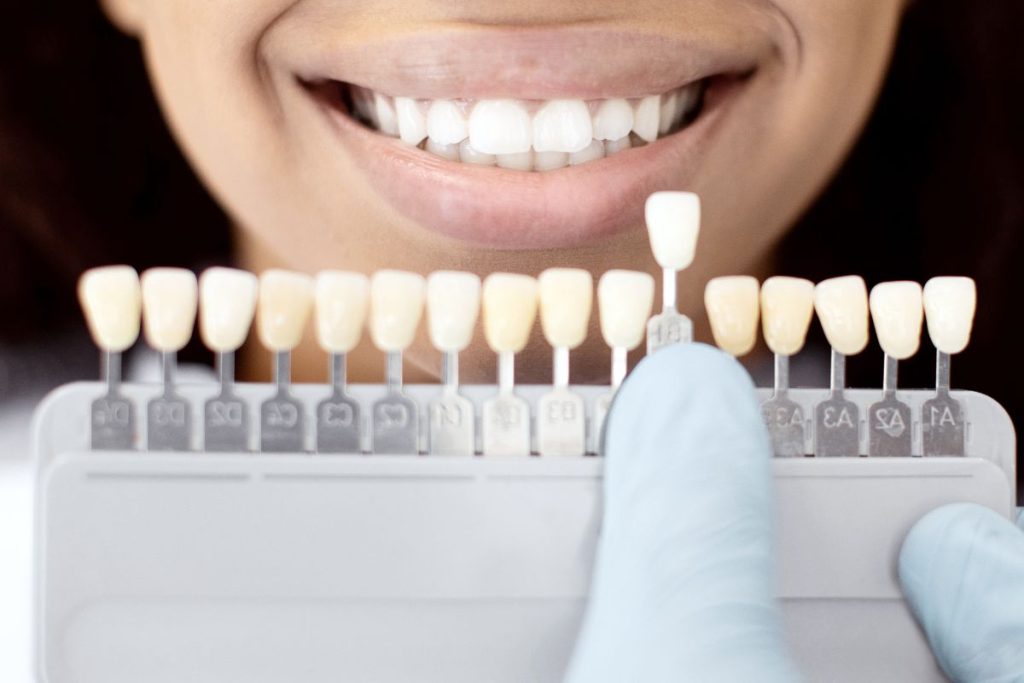 Dental Shade Matching