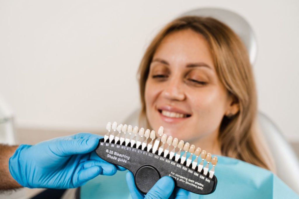 Dental Shade Matching